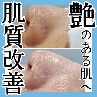 エステサロン LYSHのその他イメージ