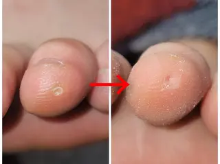 ネイル&巻き爪サロン AKnailのネイルデザイン