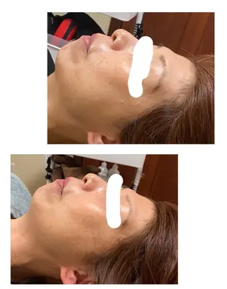 ネイル＆脱毛 Lotus🌸のネイルデザイン