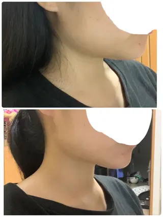 メンズ 大阪脱毛|ちぇるま| 眉毛Wax｜美肌管理のエステ・リラクイメージ