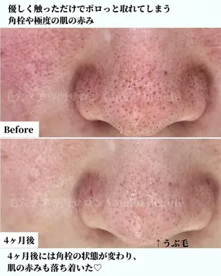 メンズ 毛穴ケア専門サロン アメリオボーテのその他イメージ