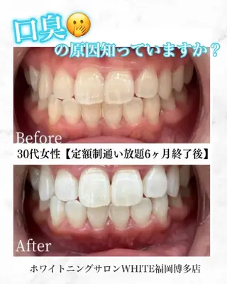 キッズ メンズ セルフホワイトニング WHITE福岡博多店のエステ・リラクイメージ