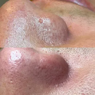 夕希 毛穴と脱毛特化サロンのエステ・リラクイメージ