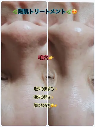 Dione 立川店のエステ・リラクイメージ