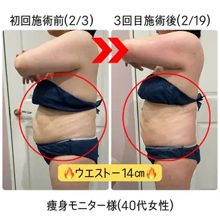 R-four🦋 土屋のエステ・リラクイメージ