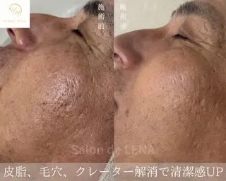 ハーブピーリング専門 グランディール　武内のエステ・リラクイメージ