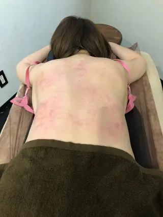 小顔矯/美容鍼/鍼灸 BeauJuのその他イメージ