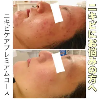フェイシャル専門 肌質改善/プランスのエステ・リラクイメージ