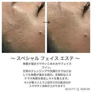 マツエク・マツパ ビューティー ミロワールのエステ・リラクイメージ