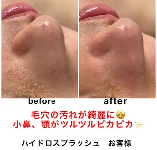 ネイル・エステサロン UILANIのネイルデザイン