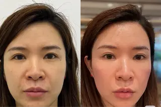 マツエク・マツパ aliaハーブ水光店 エステティシャン募集のエステ・リラクイメージ