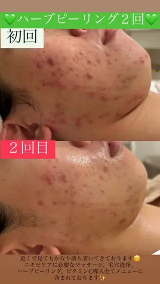 メンズ Salon de Lino 御器所のエステ・リラクイメージ