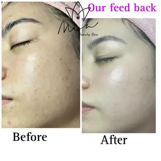 MiA Beautyのエステ・リラクイメージ