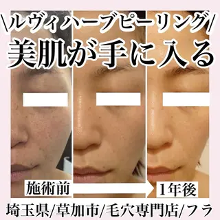 毛穴専門店hula 杉山智美のエステ・リラクイメージ