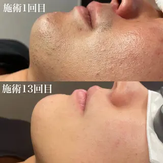 メンズ Esthetic Salon ECLIA所属・ECLIA 中田のエステ・リラクイメージ