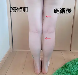 痩身/脱毛/ネイル HARUKAのエステ・リラクイメージ