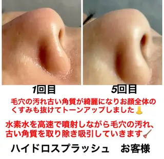 ネイル・エステサロン UILANIのネイルデザイン