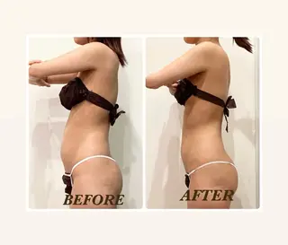 Prima 痩身脱毛 にごうかおりのエステ・リラクイメージ