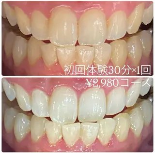 ホワイトニングルーム 横浜店のその他イメージ