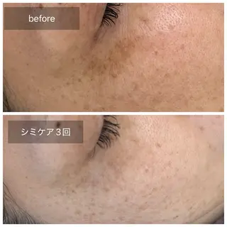 トータルしみケア専門 NICA(ニカ)の眉毛・アイブロウイメージ