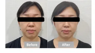 【小顔・毛穴ケア】 セラピスト　和田紋子のエステ・リラクイメージ