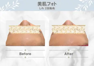 MODE K's 白石彩夏のエステ・リラクイメージ