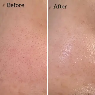 Éclat de Belle🫧白玉肌のその他イメージ