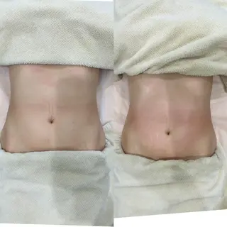 ファッショニスタ yaeのエステ・リラクイメージ