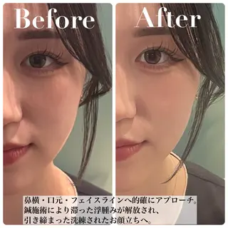 nano.face名古屋駅前店所属・美容鍼/小顔&整体 nano.faceのエステ・リラクイメージ