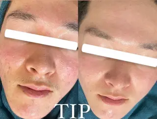 パーソナルスキンケア 🦋APRI🅿️有のエステ・リラクイメージ