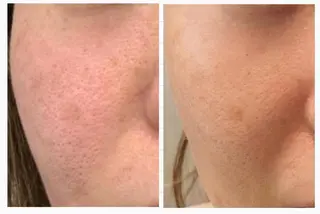 Lavieriche "ラヴィリッシュ"のエステ・リラクイメージ