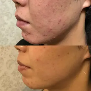 ROUN'　南 鈴沙のネイルデザイン