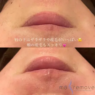 amu nail. RINAのネイルデザイン