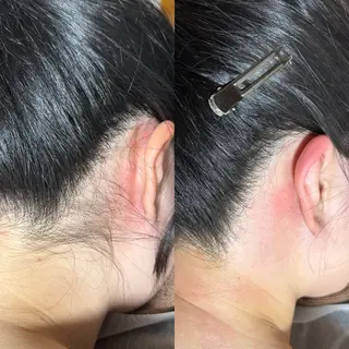 六本木脱毛andS 店長Sachiのエステ・リラクイメージ