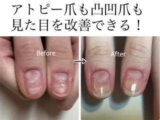 メンズ ネイル 深爪矯正専門店　ネイルサロン　トイロ所属・ネイルサロン トイロのネイルデザイン