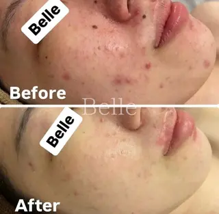 佐藤 加奈のエステ・リラクイメージ