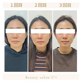 頭蓋骨小顔矯正 藤本のエステ・リラクイメージ