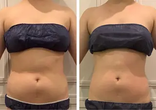 小顔EX心斎橋 REVIハーブのエステ・リラクイメージ