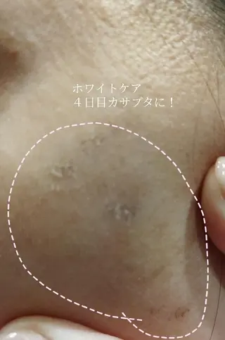 🅖🅤🅩🅔🅛 salonのエステ・リラクイメージ