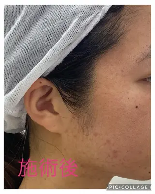 ノエビア ラボーテサロンのエステ・リラクイメージ