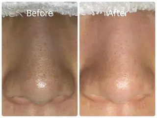 salon HATOのエステ・リラクイメージ