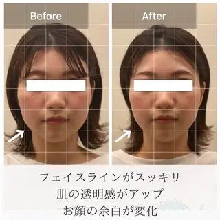 美容鍼/ヘッドスパ/ 💎さかもとのエステ・リラクイメージ