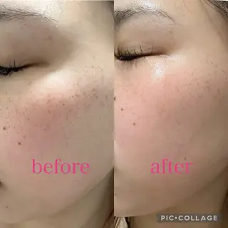 肌質改善 ×ネイルサロンのネイルデザイン