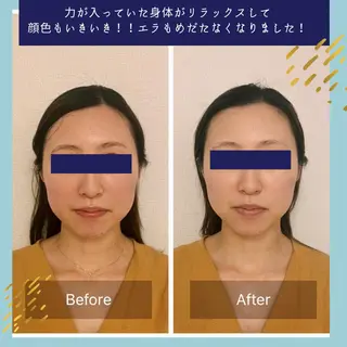 ielu〜毛穴ケア ハーブピーリングのエステ・リラクイメージ