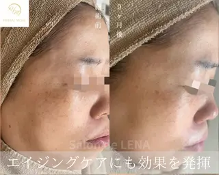 ハーブピーリング専門 サロンドレナ平岡のエステ・リラクイメージ