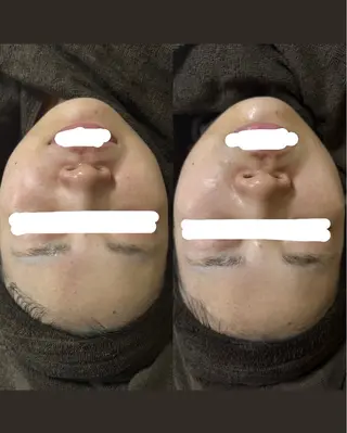 ENoa ハーブピーリング専門のエステ・リラクイメージ