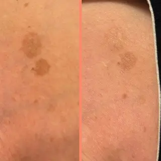 大阪大東市 / 体質・肌質改善サロン アンシャンテ所属・体質・肌質改善サロン アンシャンテのエステ・リラクイメージ