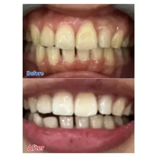 Ｍ渋谷 ホワイトニングのエステ・リラクイメージ