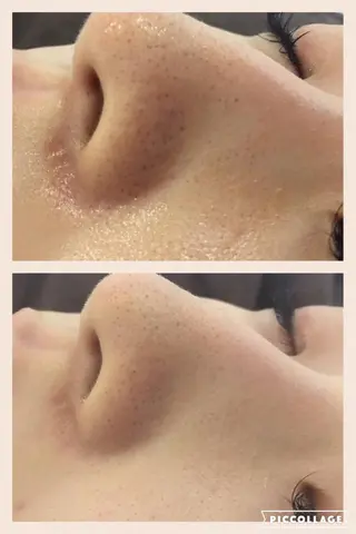 ニキビ・肌質改善専門 ♡人生が変わるサロンのエステ・リラクイメージ