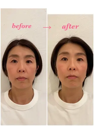 🌸美容鍼サロン🌸 メゾンブランシェ🌈のエステ・リラクイメージ